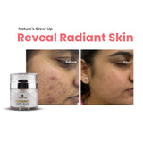 Skinovate Radiance Night serum