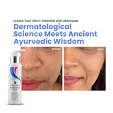 Skinovate Hyaluronic Acid Moisturizer