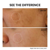 Skinovate Skin Brightening Face Wash