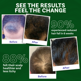 Skinovate Hair Strengthening Combo