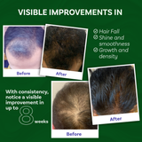 Skinovate 4-in-1 Hair Care Kit