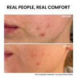 Skinovate Gentle Cleanser with Hyaluronic Acid – 200ml