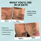 Skinovate 3-in-1 Skincare Combo –For Glowing, Hydrated & Healthy Skin