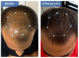 Hair Fall Control & Regrowth Combo