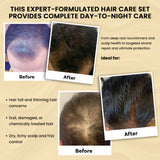 Hair Fall Control & Regrowth Combo