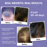 Hair Fall Control & Regrowth Combo