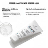 Skinovate Anti-Acne Facewash with 2% Salicylic Acid & Vitamin C – 100ml