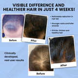 Skinovate Hair Regrowth & Strength Combo