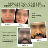 Skinovate 5-in-1 Skincare Combo –For Glowing, Hydrated & Healthy Skin