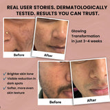 Skinovate Glow + Moisture Daily Skincare Combo