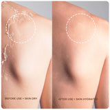 Skinovate Hyaluronic Acid Moisturizer