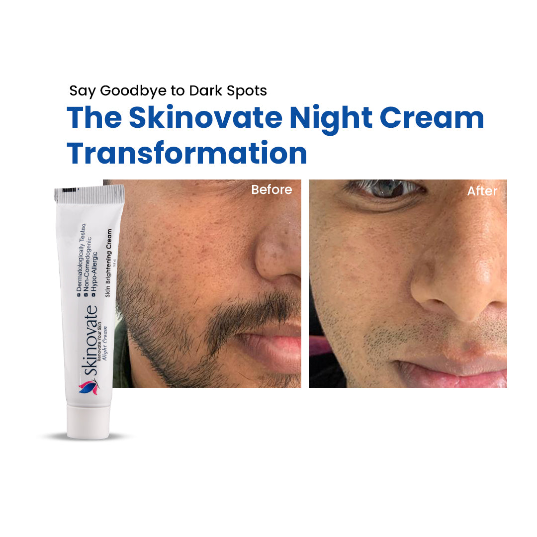Skinovate Skin brightening Night Cream
