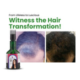Skinovate Hair Oil | Dermatologically Tested | Promotes Hair Growth