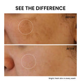Glow Shots Pack of 2 |  Free Skin Brightening Face Wash