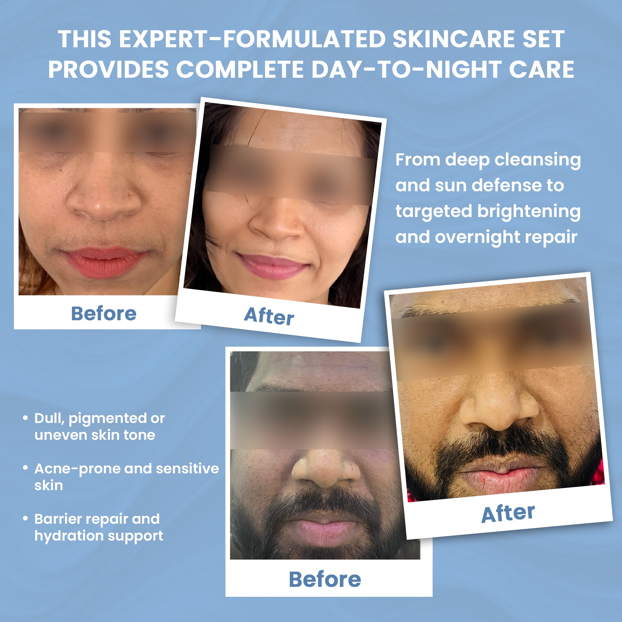 Skinovate 4-in-1 Skincare Combo –For Glowing, Hydrated & Healthy Skin