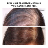 Hair Fall Control & Regrowth Combo