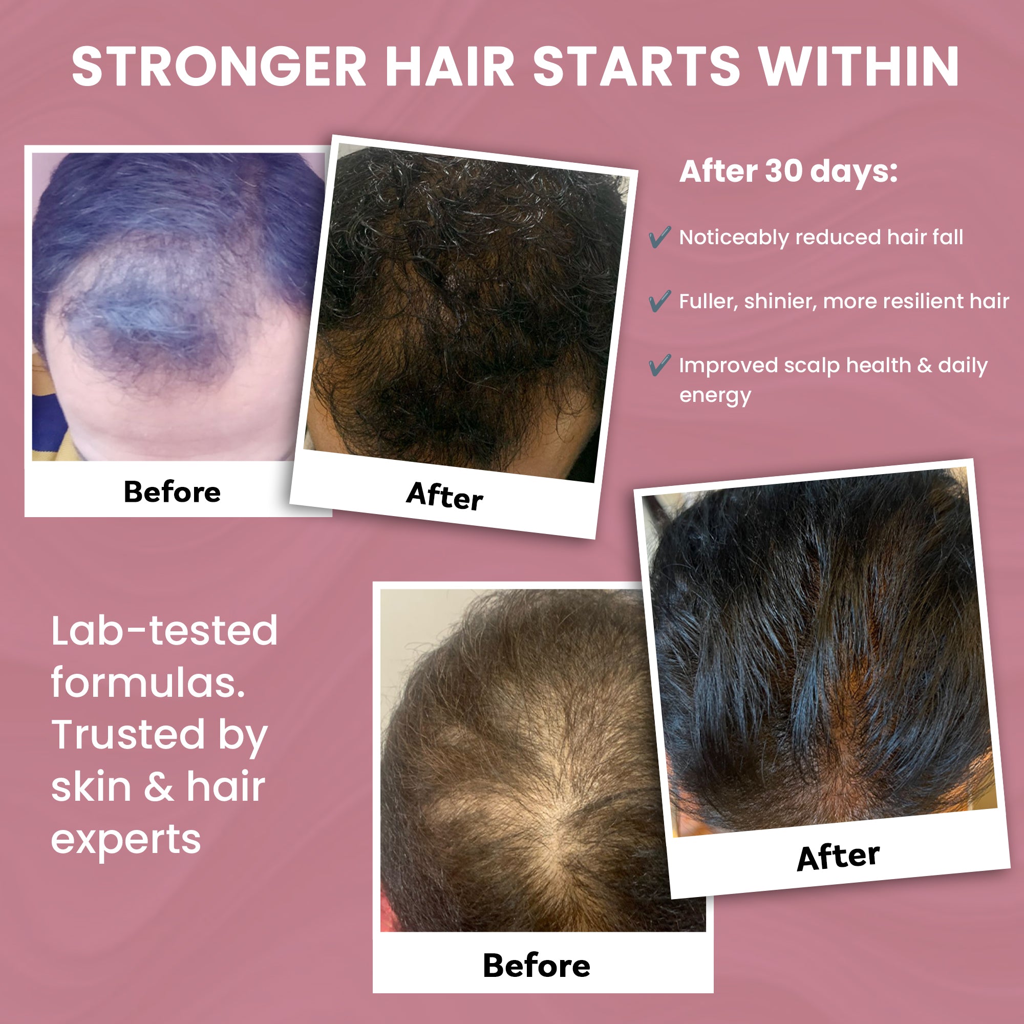 Skinovate Inner Strength & Hair Wellness Combo