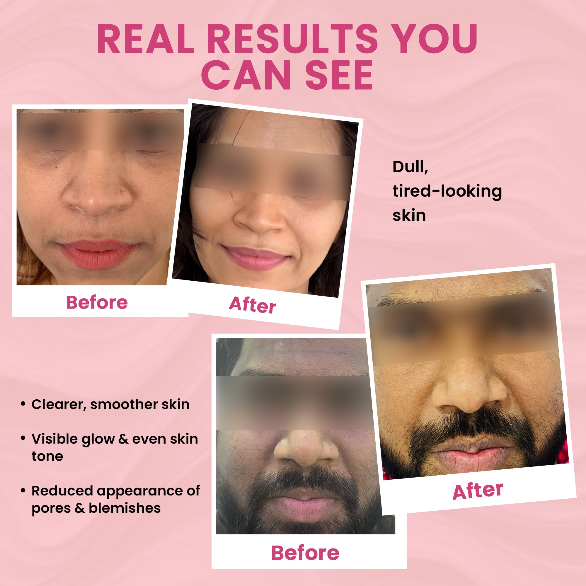 Skinovate Face Wash + Night Cream combo