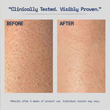 Skinovate Hyaluronic Acid Moisturizer